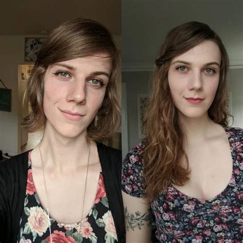 Softening of the skin as well as changes in facial and body hair growth will change. . Mtf hrt dosage timeline